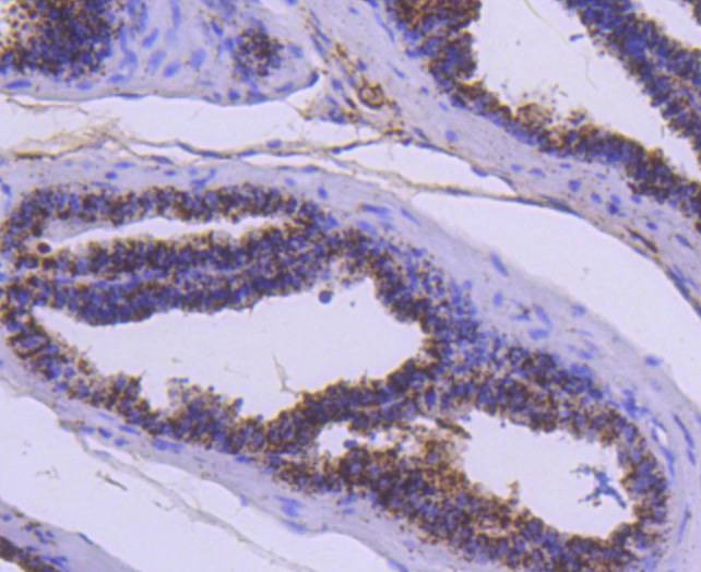 Anti-Cathepsin D Antibody (4I539)
