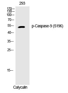 Anti-Phospho-CASP9 (Ser196) Polyclonal Antibody