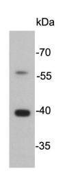 Anti-Cathepsin B Antibody (8S344)