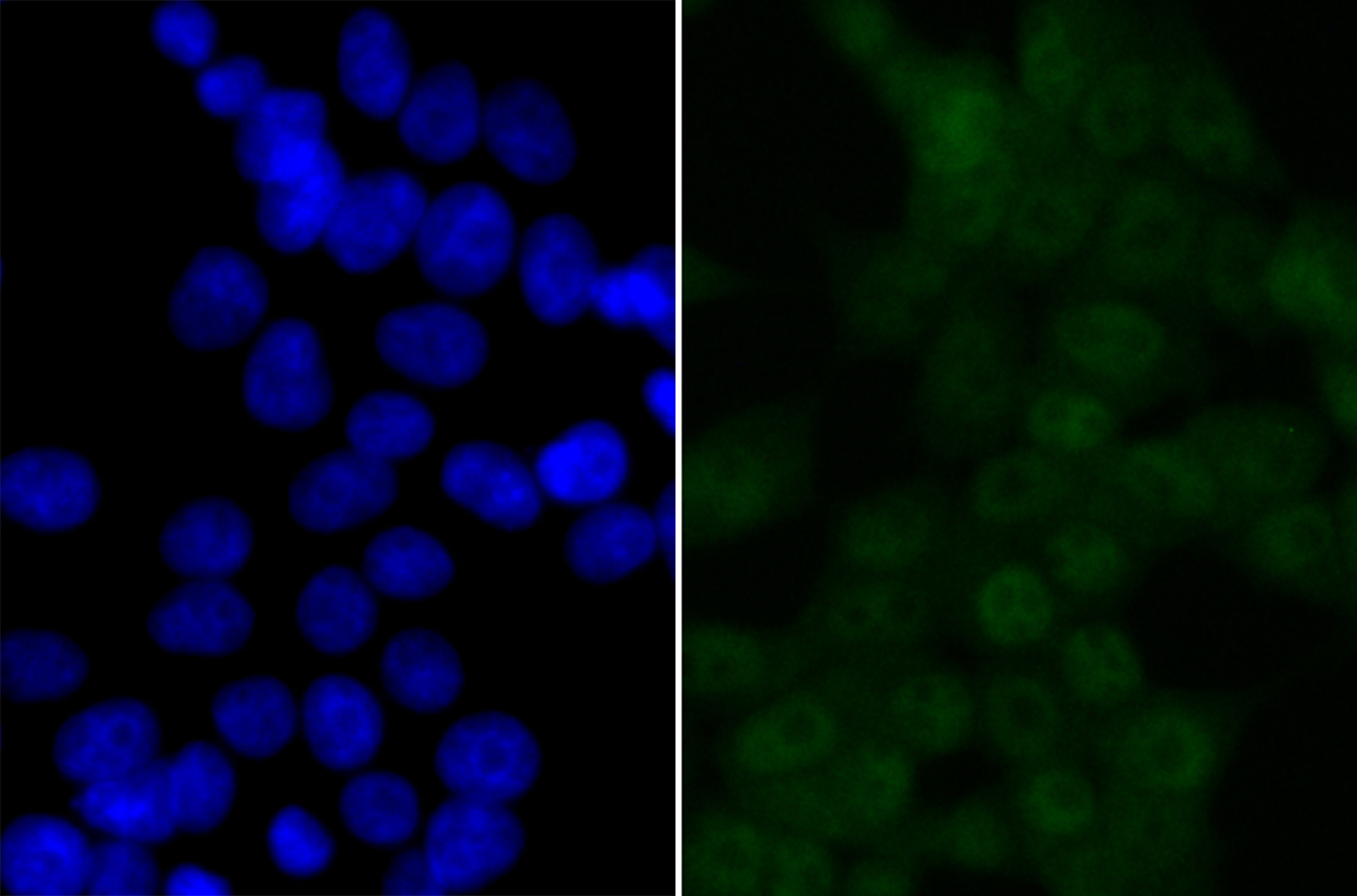 Anti-BRD2 Antibody (7Q375)
