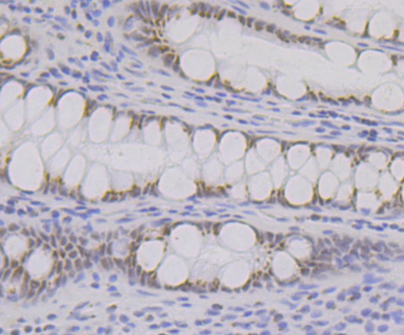 Anti-BRD2 Antibody (7Q375)
