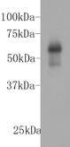 Anti-Breast cancer-overexpressed gene 1 protein Antibody (1N989)