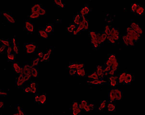 Anti-Cathepsin B Antibody (8S344)