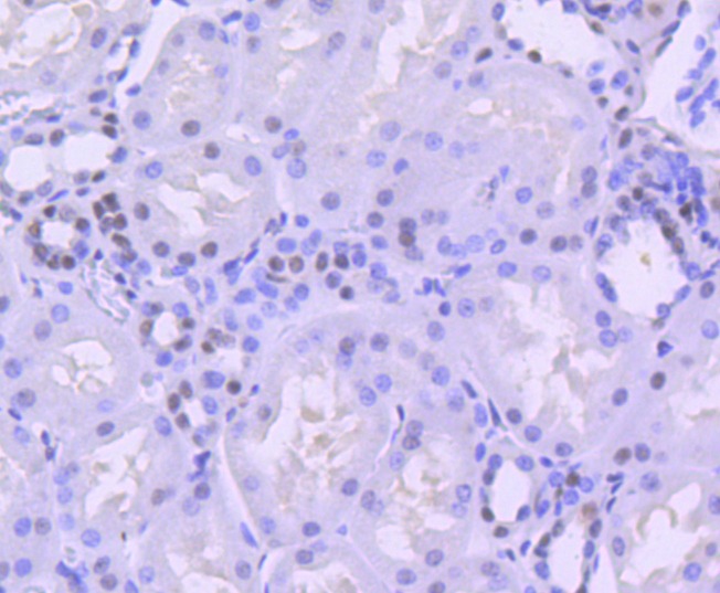 Anti-SMARCA4 Antibody (3I277)