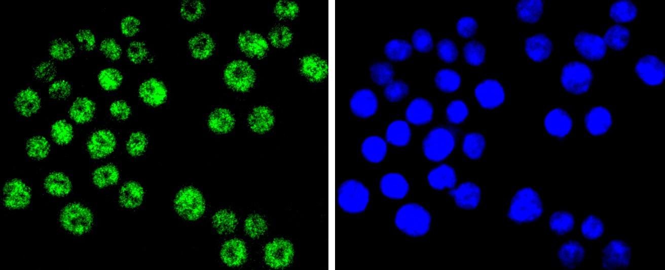 Anti-SMARCA4 Antibody (3I277)