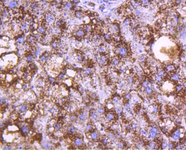 Anti-Cathepsin D Antibody (4I539)