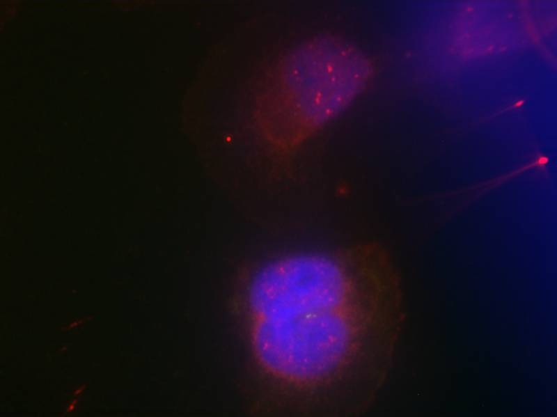Anti-Phospho-BRCA1 (Ser988) Polyclonal Antibody