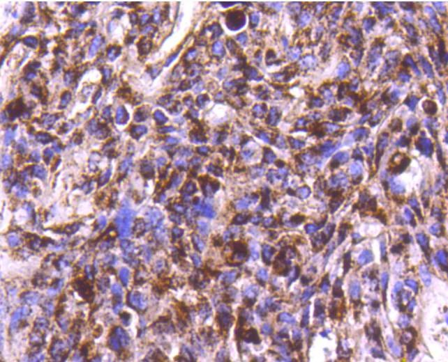 Anti-Cathepsin D Antibody (4I539)