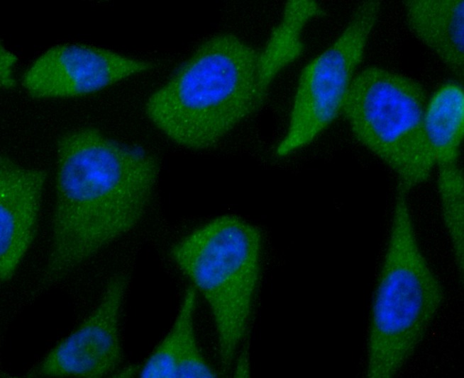 Anti-C12orf51 Antibody (8V885)