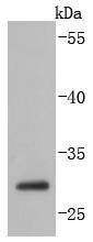 Anti-Caspase-14 Antibody (3A777)