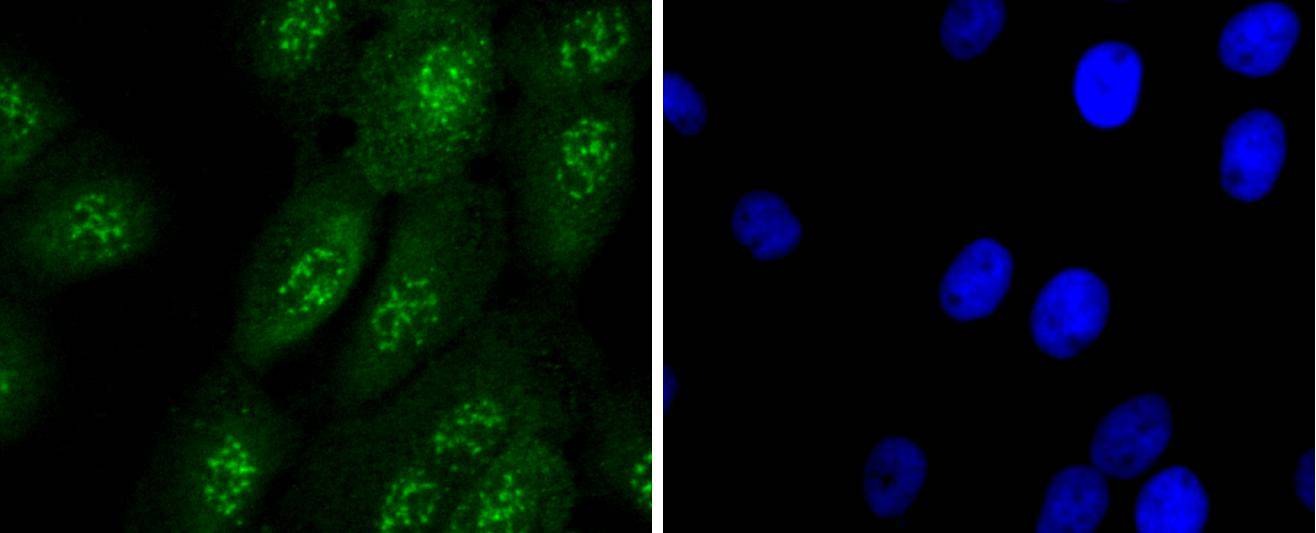 Anti-Caspase-14 Antibody (3A777)