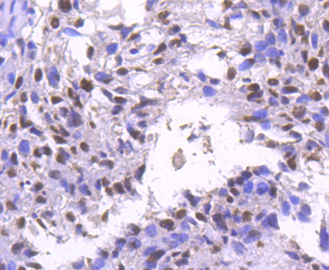 Anti-SMARCA4 Antibody (3I277)