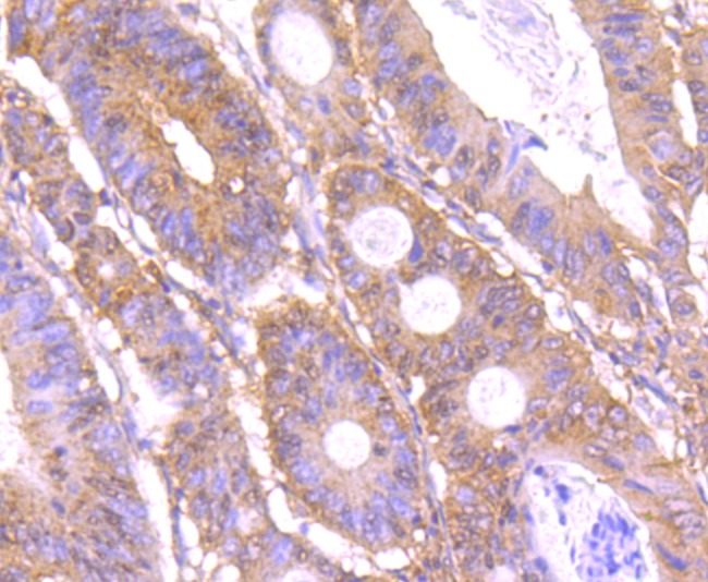 Anti-C12orf51 Antibody (8V885)