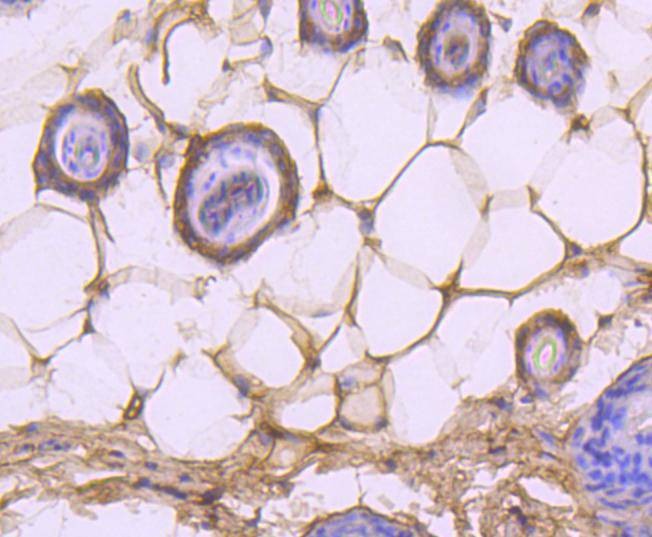 Anti-Caspase-14 Antibody (3A777)