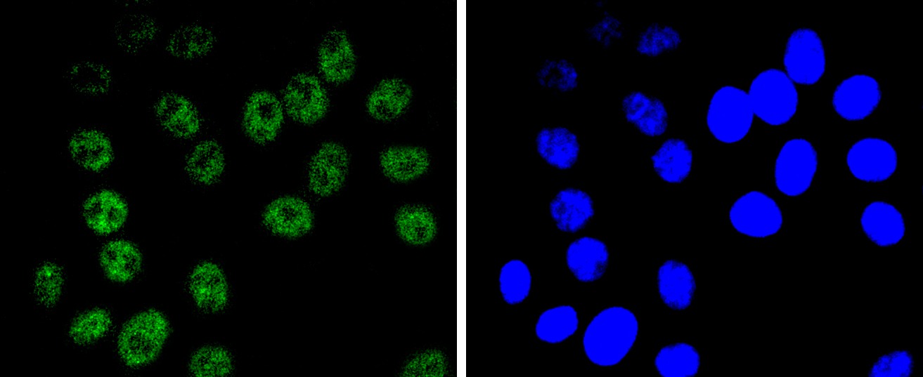 Anti-SMARCA4 Antibody (3I277)