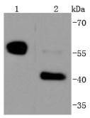 Anti-Caspase-8 Antibody (4B478)