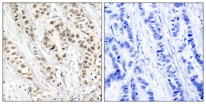 Anti-Phospho-BRCA1 (Ser1524) Polyclonal Antibody