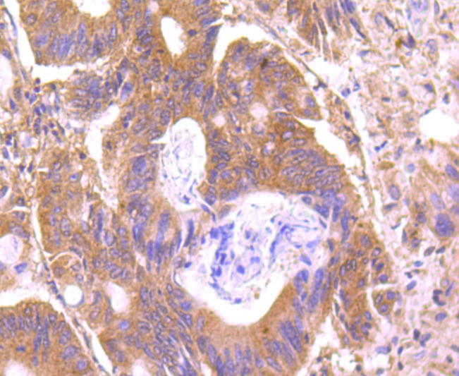 Anti-C14orf93 Antibody (8U54)