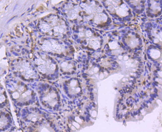 Anti-SMARCA4 Antibody (3I277)