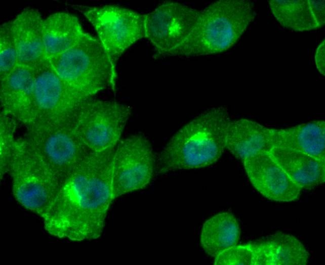 Anti-Cathepsin D Antibody (4I539)