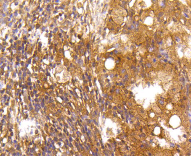 Anti-CASP2 Antibody (8H206)