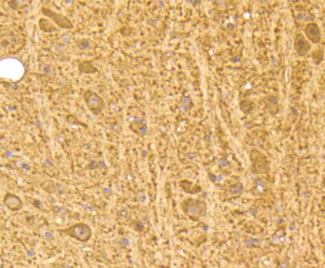 Anti-CALM1 Antibody (9G576)