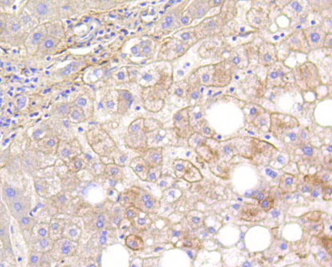 Anti-CNN1 Antibody (5Y848)