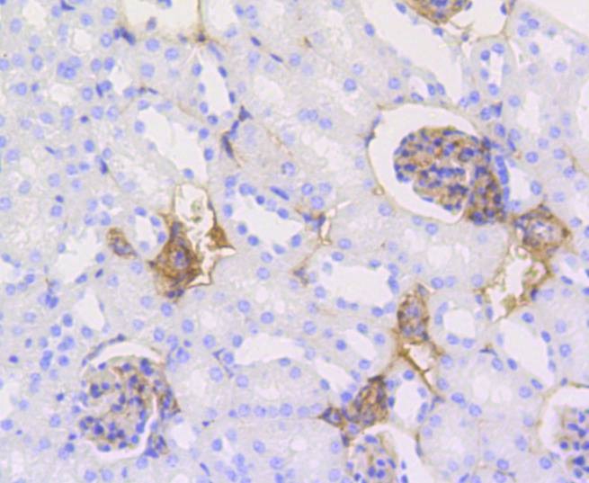 Anti-Caldesmon Antibody (6J397)