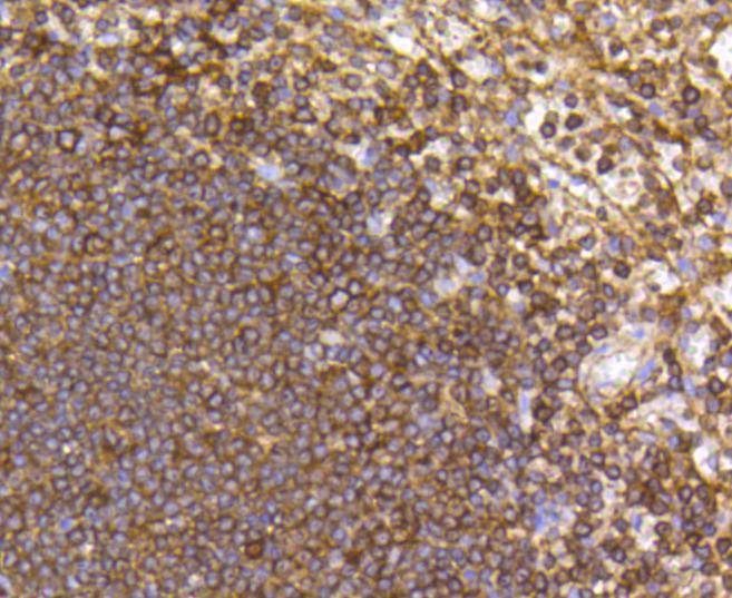 Anti-CCR7 Antibody (8C836)