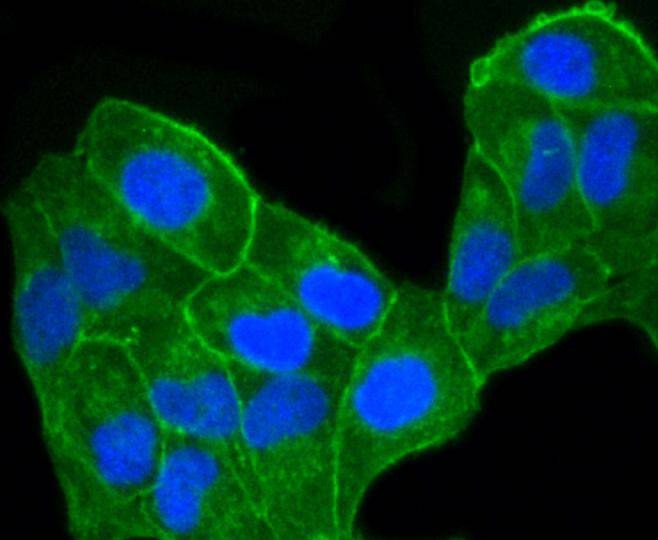 Anti-CCR7 Antibody (8C836)