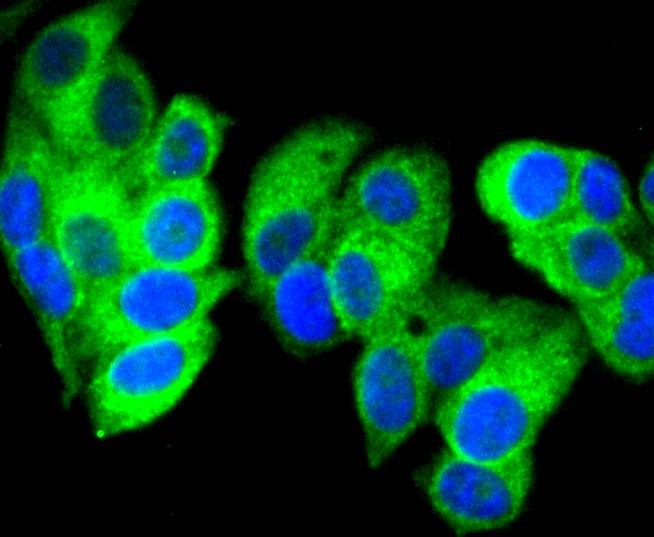 Anti-Calreticulin Antibody (8J512)