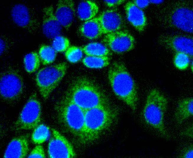 Anti-CNN1 Antibody (5Y848)