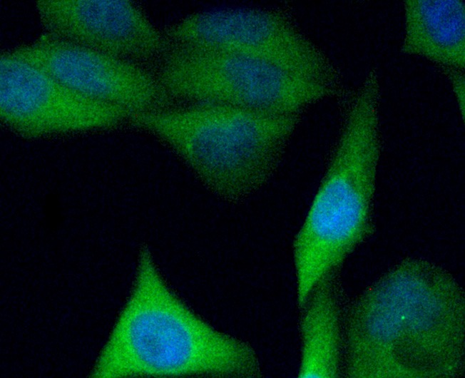 Anti-C10orf58 Antibody (6V65)