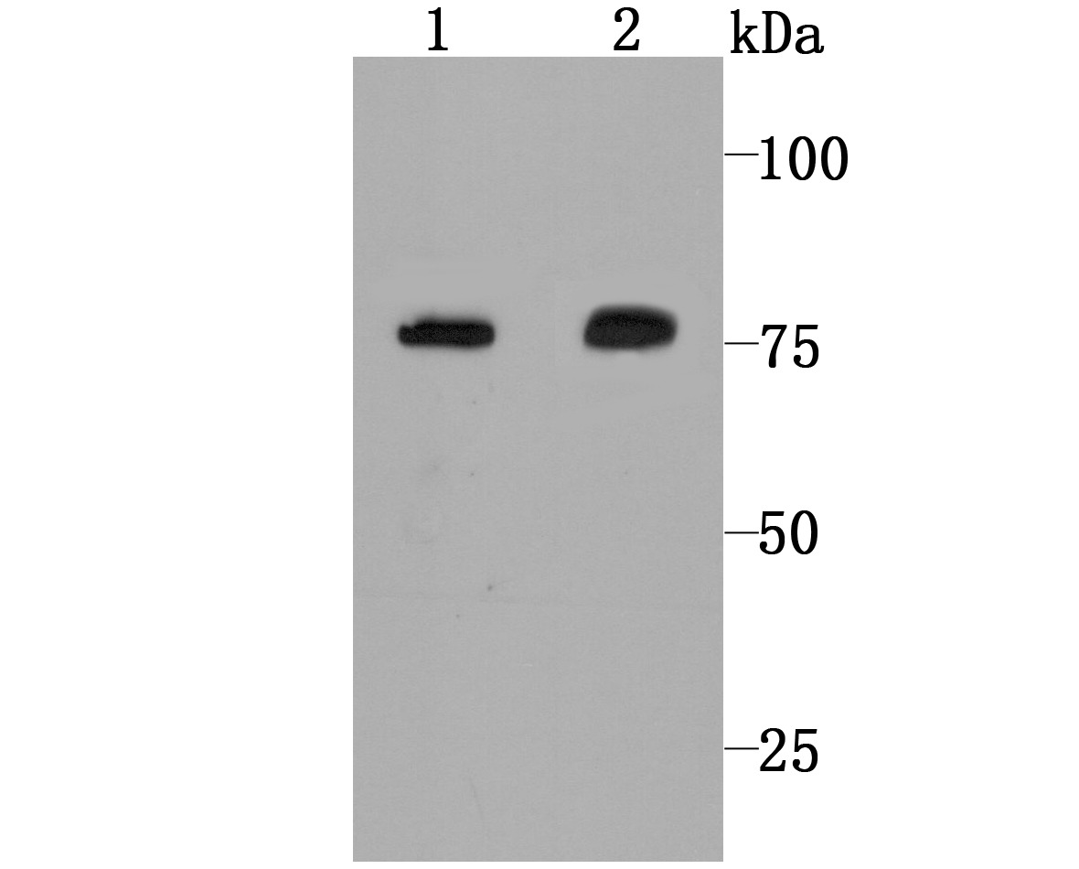 Anti-CAPN2 Antibody (6Z187)