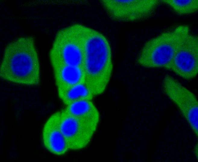 Anti-CALM1 Antibody (9G576)