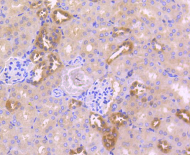 Anti-Caspase-6 Antibody (5J689)
