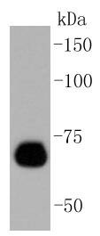 Anti-Caldesmon Antibody (6J397)