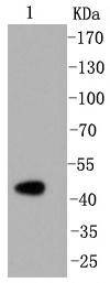 Anti-CASP2 Antibody (8H206)