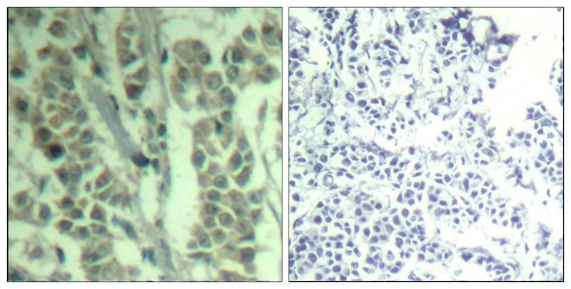 Anti-Phospho-CBL (Tyr700) Polyclonal Antibody
