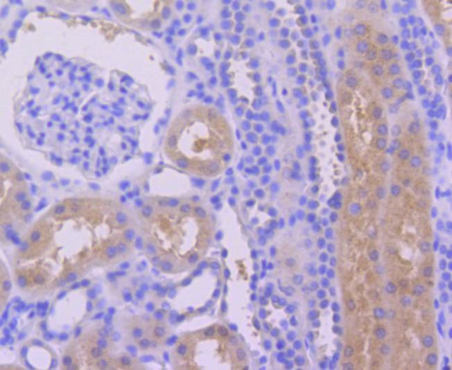 Anti-Caspase-6 Antibody (5J689)