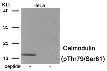 Anti-Phospho-CALM1 (Thr79, Ser81) Polyclonal Antibody