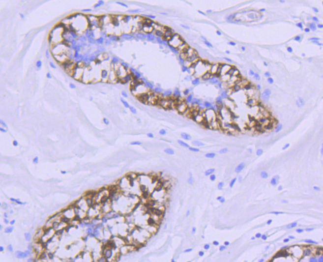 Anti-CNN1 Antibody (5Y848)