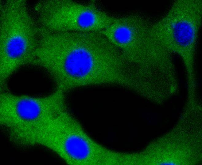 Anti-CALM1 Antibody (9G576)