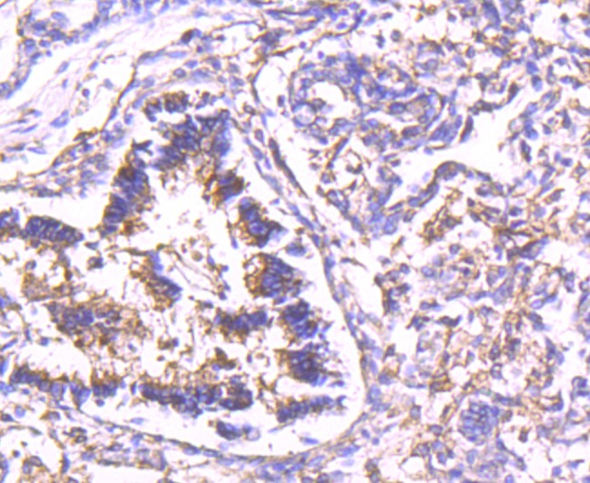 Anti-CAPN2 Antibody (6Z187)