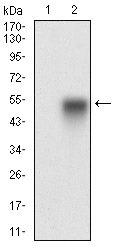 Anti-CAV2 Antibody (8Z468)