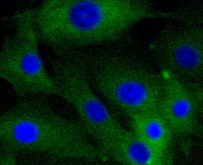 Anti-Caldesmon Antibody (6J397)