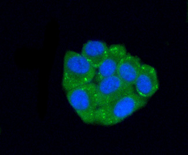 Anti-C10orf58 Antibody (6V65)