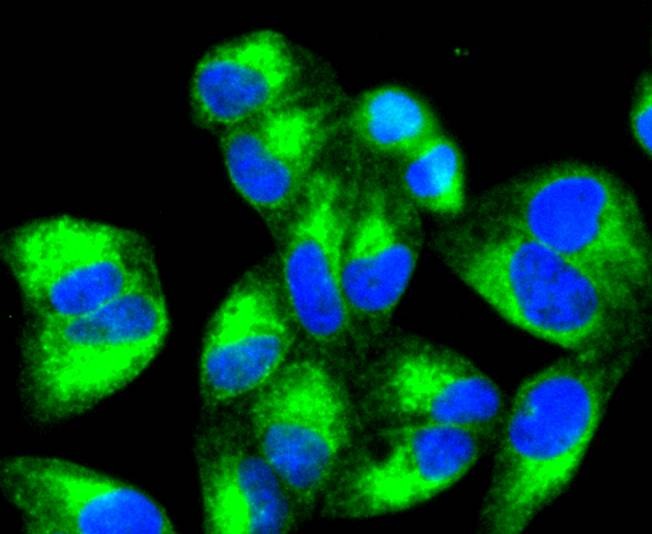 Anti-Calreticulin Antibody (8J512)