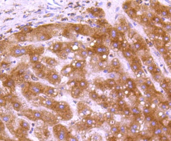 Anti-Calreticulin Antibody (8J512)