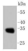 Anti-CNN1 Antibody (5Y848)